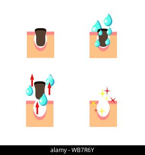 Regelung der Reinigung haut Prozess, Vector Illustration auf weißem Hintergrund Stock Vektor