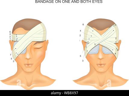 Vector Illustration der Verband auf der einen und beide Augen Stock Vektor