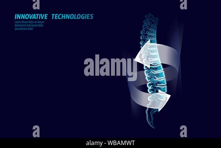 Die menschliche Wirbelsäule Verletzungen Physiotherapie Schutz. Schmerzen im Bereich der Chirurgie operation Pflege moderne Lende Medizin Technologie Low Poly Dreiecke. 3D-Render zurück Stock Vektor