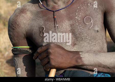 Vertikufikation am Oberkörper, Mursi-Stamm, unteres Omo-Tal, Äthiopien Stockfoto