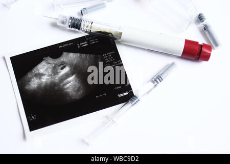 Technik der assistierten Reproduktion pen und kleine Spritzen mit ovarian Ultraschall in der Mitte. IVF und IUI Behandlung Medikamente. Stockfoto