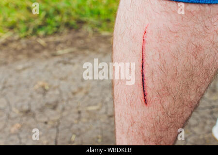 Unschärfe der Wunde ein Knie fließt Blut ist rot geschnitten auf der Haut. medizinisches Konzept Stockfoto