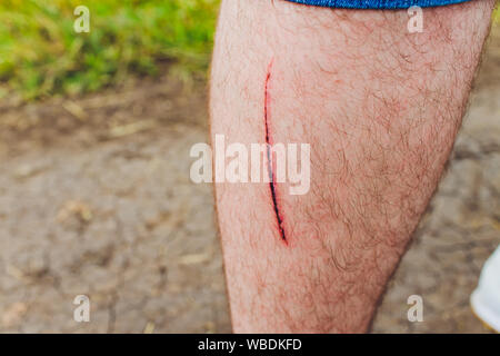 Unschärfe der Wunde ein Knie fließt Blut ist rot geschnitten auf der Haut. medizinisches Konzept Stockfoto