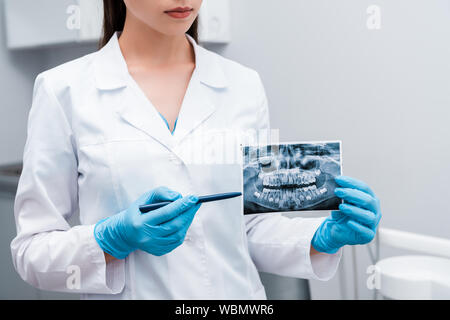 7/8-Ansicht von Zahnarzt in blau Latex Handschuhe die Feder in der Nähe von x-ray Stockfoto