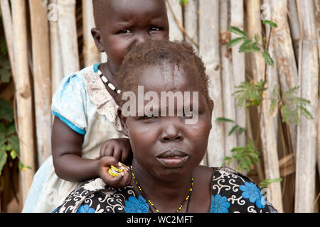 TORIT, SOUTH SUDAN - 21. FEBRUAR 2013: Nicht identifizierte Frau mit Verheilten Kopfverletzung kümmert sich um ihre Tochter im Südsudan Stockfoto