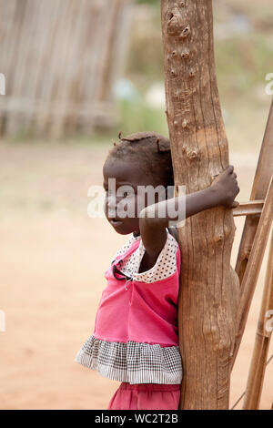 TORIT, SOUTH SUDAN - 21. FEBRUAR 2013: Nicht identifizierte Kind mit Anzeichen von Unterernährung in der Stadt Torit, South Sudan Stockfoto