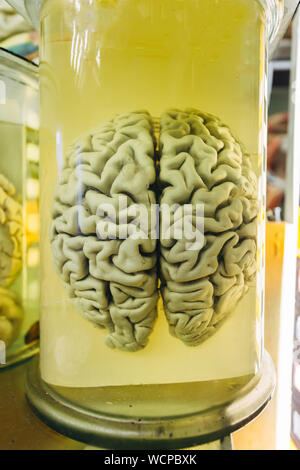 Menschliche Gehirn im Glas Glas mit Formaldehyd für medizinische Studien. Stockfoto