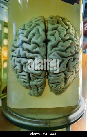 Menschliche Gehirn im Glas Glas mit Formaldehyd für medizinische Studien. Stockfoto