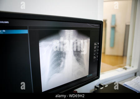 Details mit einem Thorakalen X-Ray auf einem Computer Monitor innerhalb einer Klinik Stockfoto