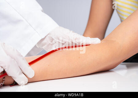Arzt stellt eine Kanüle auf den Arm des Patienten Stockfoto