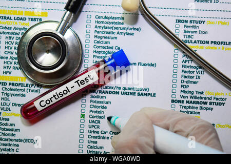 Cortisol-Test mit Blutprobe. Draufsicht auf Büro Schreibtisch isoliert. Healthcare/Medical Konzept Stockfoto