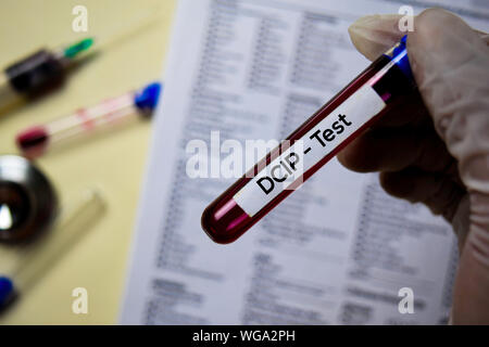 DCIP-Test mit Blutprobe. Draufsicht auf Büro Schreibtisch isoliert. Healthcare/Medical Konzept Stockfoto