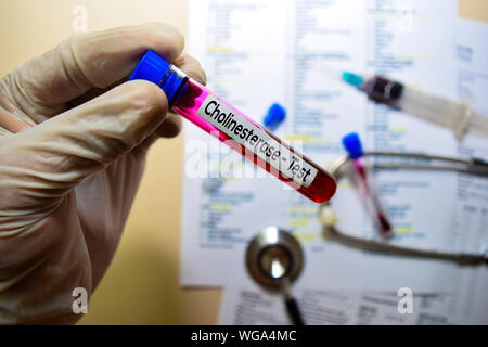Cholinesterase-Test mit Blutprobe. Draufsicht auf Büro Schreibtisch isoliert. Healthcare/Medical Konzept Stockfoto