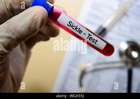 Sichel - Test mit Blutprobe. Draufsicht auf Büro Schreibtisch isoliert. Healthcare/Medical Konzept Stockfoto