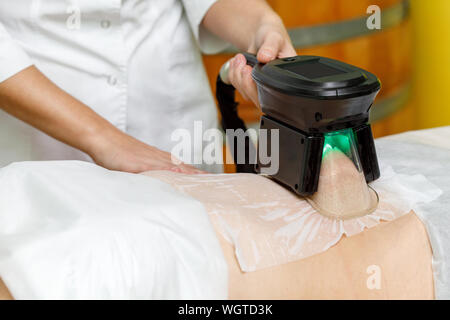 Cryolipolysis fett Kältebehandlung. Gewichtsabnahme und schlankheits Verfahren im Beauty Salon Stockfoto