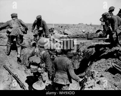 WW1: Captured Moyenneville. Deutsche Kriegsgefangene Rücknahme die Verwundeten. Kreuzung alte Deutsche 2. Zeile. 21. August 1918. Stockfoto