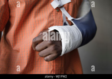 Closeup Mittelteil eines Mannes mit gebrochenen Arm in Gips Stockfoto