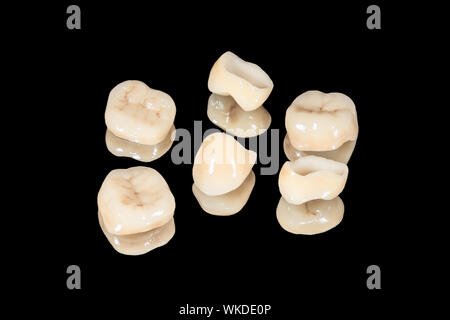 Keramische Kronen und Veneers. Auf schwarzem Hintergrund in der Nähe isolieren. Dentallabor Stockfoto