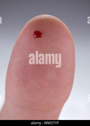 Makro-Ansicht eines Tropfens echtes Blut auf eine menschliche Daumen. Stockfoto