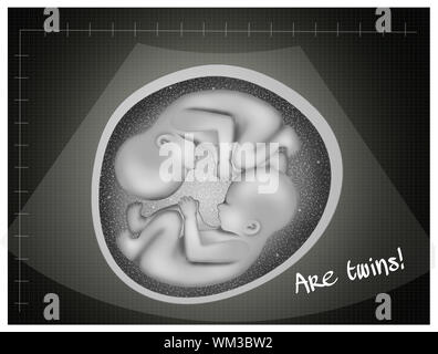 Ultraschall der Zwillinge Stockfoto