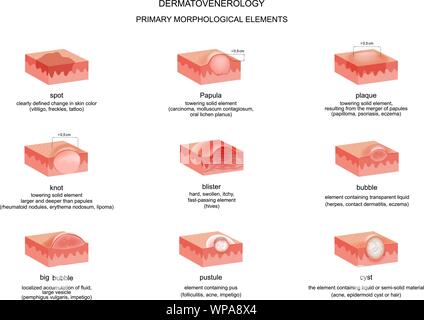 Vector Illustration der dermatologischen Elemente in den verschiedenen Krankheiten Stock Vektor