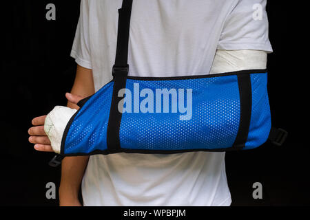 Mann mit gebrochenen Arm gewickelt Medizinische cast Gips und blauen verband. Fiberglas cast für das Handgelenk, Arm, Ellenbogen nach Sport Unfall, bei Bl isoliert Stockfoto