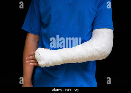 Mann mit gebrochenen Arm gewickelt Medizinische cast Gips. Fiberglas cast für das Handgelenk, Arm, Ellenbogen nach Sport Unfall, isoliert auf Schwarz Stockfoto