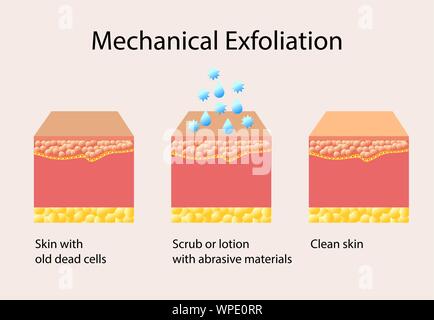 Mechanische Peeling oder Peeling, Vektor, Abbildung auf hellen Hintergrund Stock Vektor