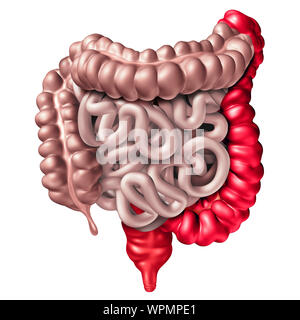 Colitis ulcerosa, einer entzündlichen Darmerkrankung mit einem menschlichen Rektum und Doppelpunkt als verdauungssystem Orgel und Verdauung Körperteil Konzept. Stockfoto