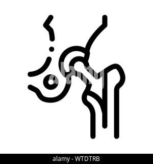 Hip Implantat Austausch Biomaterial Vektor Icon Stock Vektor