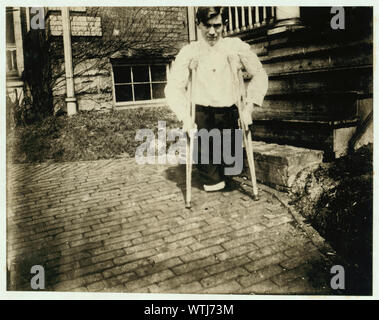 Monongah, W. Virginia Nola McKinney, Sekretärin, 1910, West Virginia Kinderarbeit Ausschuss. Frank S......., deren Beine durch ein Auto in einem Kohlebergwerk in West Virginia geschnitten wurden, wenn er 14 Jahre 10 Monate alt. Fotografien aus den Aufzeichnungen des Nationalen Kinderarbeit Committee (USA) Stockfoto