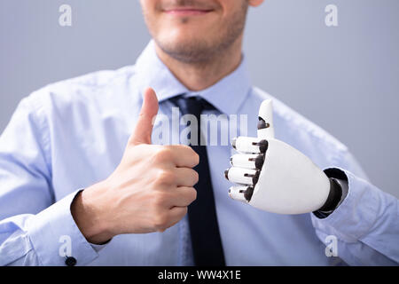 Unternehmer mit Prothetische Extremität, Daumen hoch. Künstliche Gliedmaßen Stockfoto