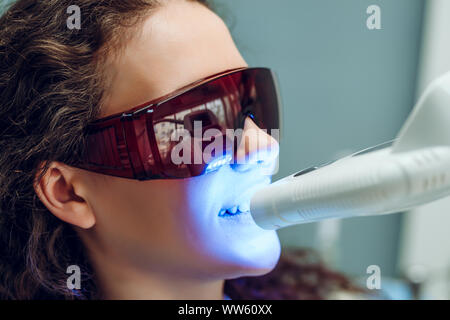 Laser Zahnaufhellung bei dantist Zimmer. Zähne, die für die Frau. Bleichen der Zähne beim Zahnarzt Klinik. Stockfoto