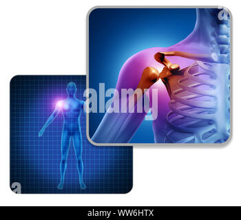 Menschliche Schultergelenk schmerzen Konzept als Skelett und Muskel Anatomie des Körpers mit Halsschmerzen Entzündung als eine schmerzhafte Verletzung oder Arthritis Krankheit Symbol. Stockfoto