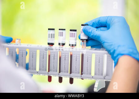 Blutkörperchensenkungsgeschwindigkeit Test im Labor Stockfoto