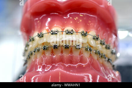Klammern auf ein Modell der menschlichen Zähne, Dental Zahn Zahnheilkunde close-up Stockfoto