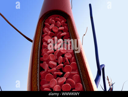 Die Kontraktion der Blutgefäße auf einem Herz Hintergrund, Arterie mit einem abgetrennten Bereichs angezeigt Stockfoto