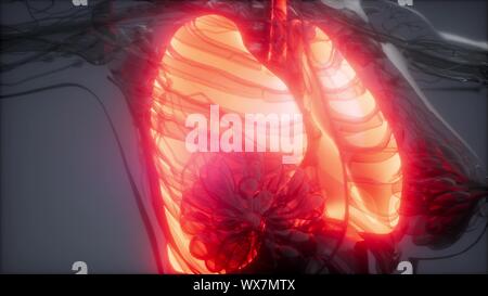 Die menschliche Lunge Radiologie Prüfung Stockfoto