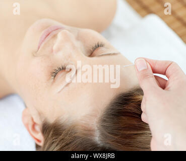 Akupunktur Nadeln auf dem Kopf eines attraktiven Frau in einem Spa Center Stockfoto