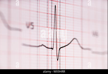 Detailansicht der EKG-Kurve. Elektrokardiographen Stockfoto