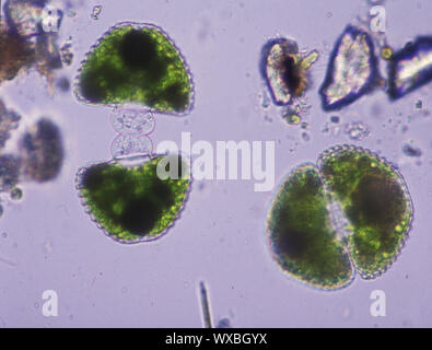 Zierpflanzen Algen in der Division unter dem Mikroskop 100x Stockfoto