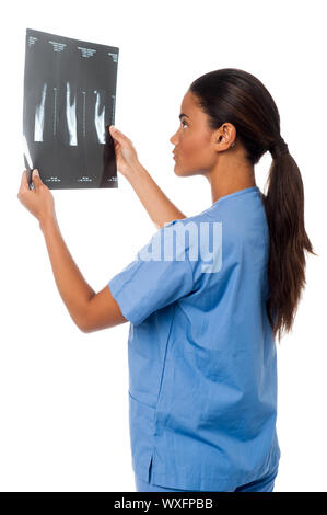 Junge Ärztin Analyse x-ray Bericht über ihre Patienten Stockfoto
