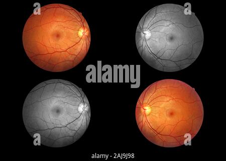 Anatomía del ojo humano, la retina, el disco óptico arteria y vena etc. Foto de stock