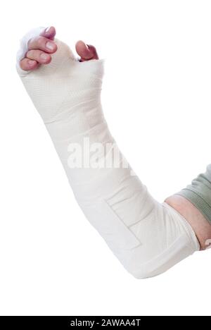 Dedo en una férula. Mano de mujer aislado en blanco Fotografía de stock