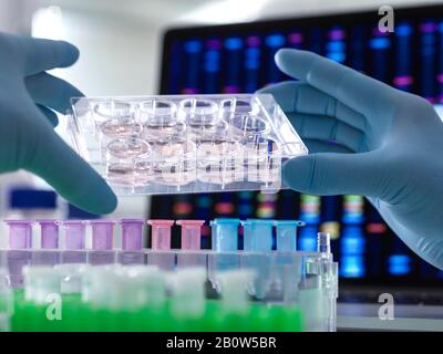 Científicos que pipetean muestras de ADN en tubos de microcentrífuga durante un experimento en el laboratorio con el perfil de ADN en la pantalla del monitor. Foto de stock