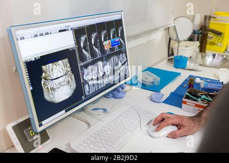 Dentista que examina la radiografía de un paciente en la pantalla de la computadora. Foto de stock