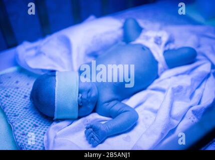 Bebé Recién Nacido Bajo Luz Ultravioleta Imagen de archivo