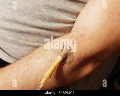 Foto de primer plano de la mano masculina con un gotero insertado en una vena Foto de stock