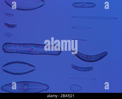Las diatomeas del mar bajo el microscopio 100x