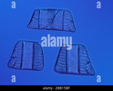 Las diatomeas del mar bajo el microscopio 100x